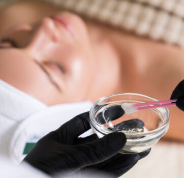 PEELING TCA – MUST HAVE W GABINECIE KOSMETOLOGA